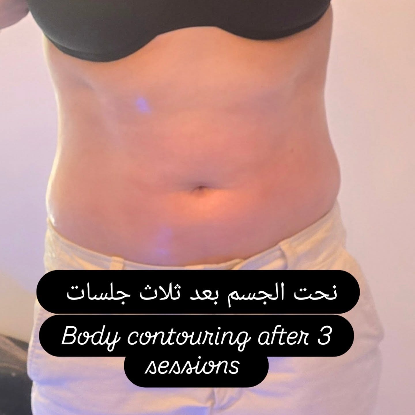 Body contouring session at Golden Beauty Arts in Mississauga