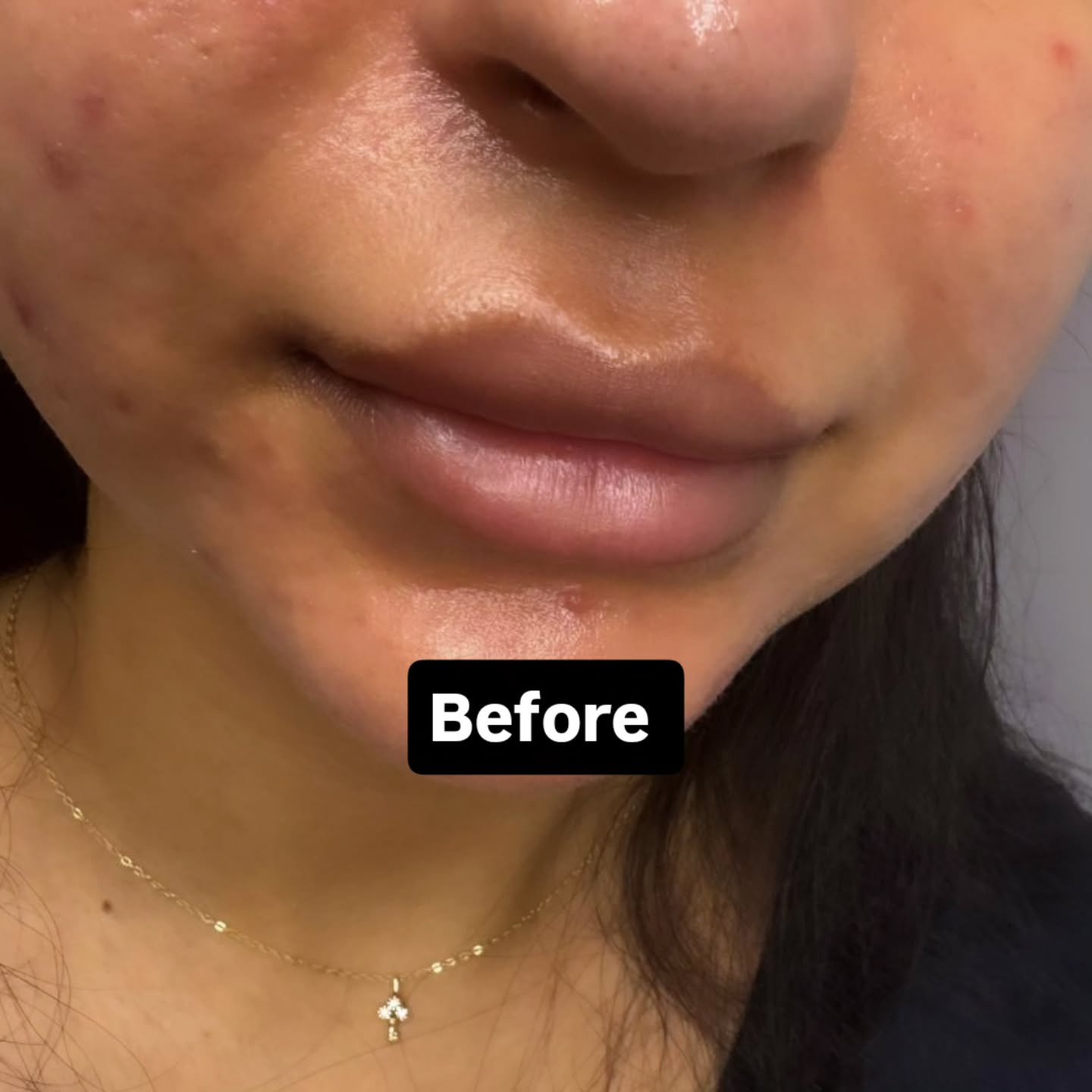 Dark lip neutralization at Golden Beauty Arts in Mississauga